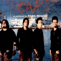 Scars